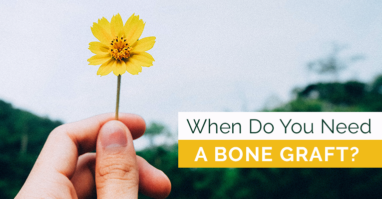 whne do you need a bone graft?