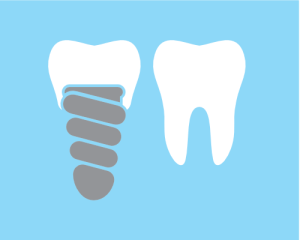 3. LearnTheLingoImplants
